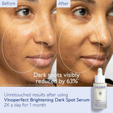 Vinoperfect Brightening Dark Spot Serum Vitamin C Alternative