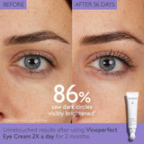Vinoperfect Dark Circle Brightening Eye Cream with Niacinamide