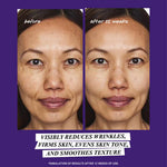 Micro-Dose Anti-Aging Retinol Serum with Ceramides and Peptide