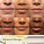 Sugar Advanced Therapy Treatment Lip Balm