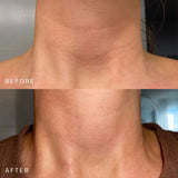 Neck Occlusion Patch™