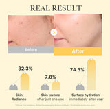 Kojic Acid Turmeric Gold Jelly Gel Mask