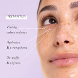 Skin Remedy Soothing Eye Gels