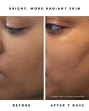 Nova 15% Vitamin C + Turmeric Brightening Serum