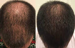 Revolve Hair Loss Shampoo Treatment For Men
